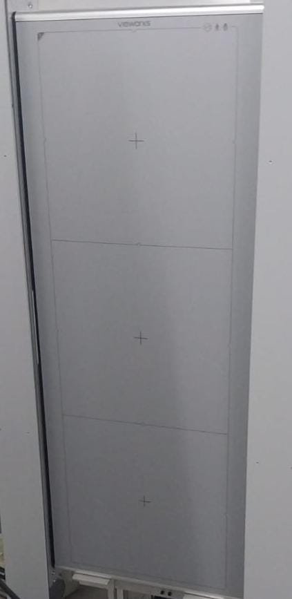 Digitalizador 1751 S especializado en estudios de espinografía